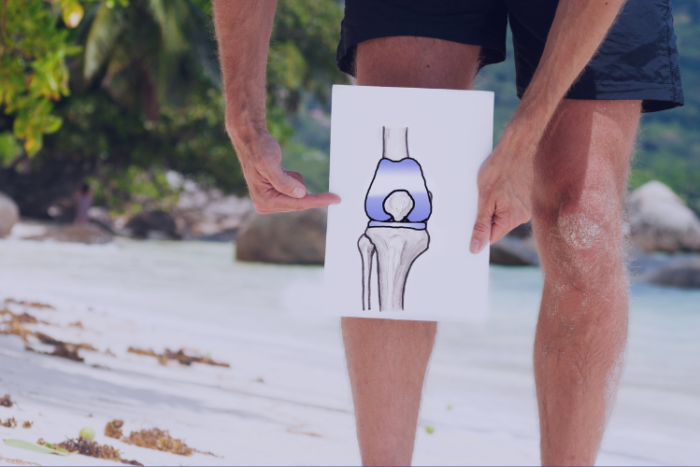 Robotic Arm Assisted Total Knee Replacements Pros Cons Man holding a paper with a diagram of total knee replacement