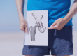 Man holding diagram of hip replacement implant over his hip